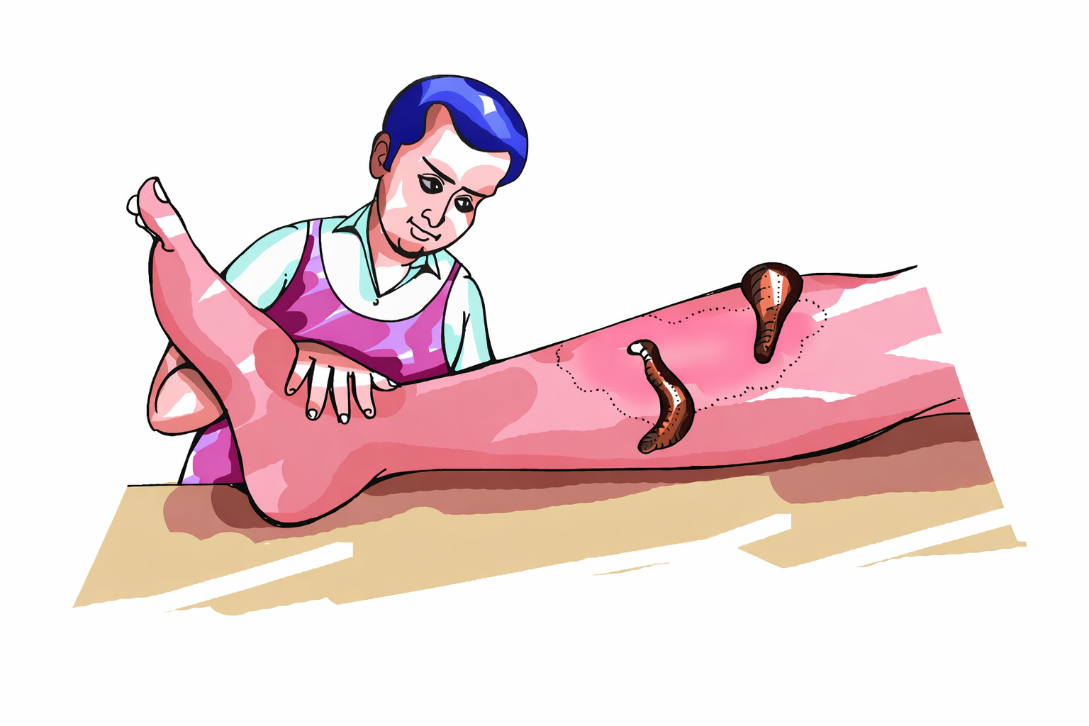 Raktamokshan Therapy